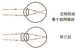 月食现象是由于形成的;通过平面镜看到挂钟的